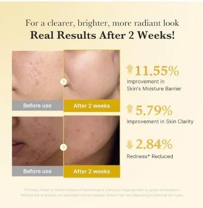 Medicube Kojic Acid Turmeric Niacinamide Serum – (30ml) - Image 4