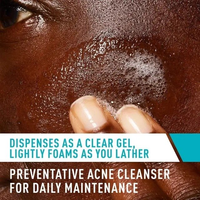 Cerave Acne Control Cleanser – (237ml) - Image 2