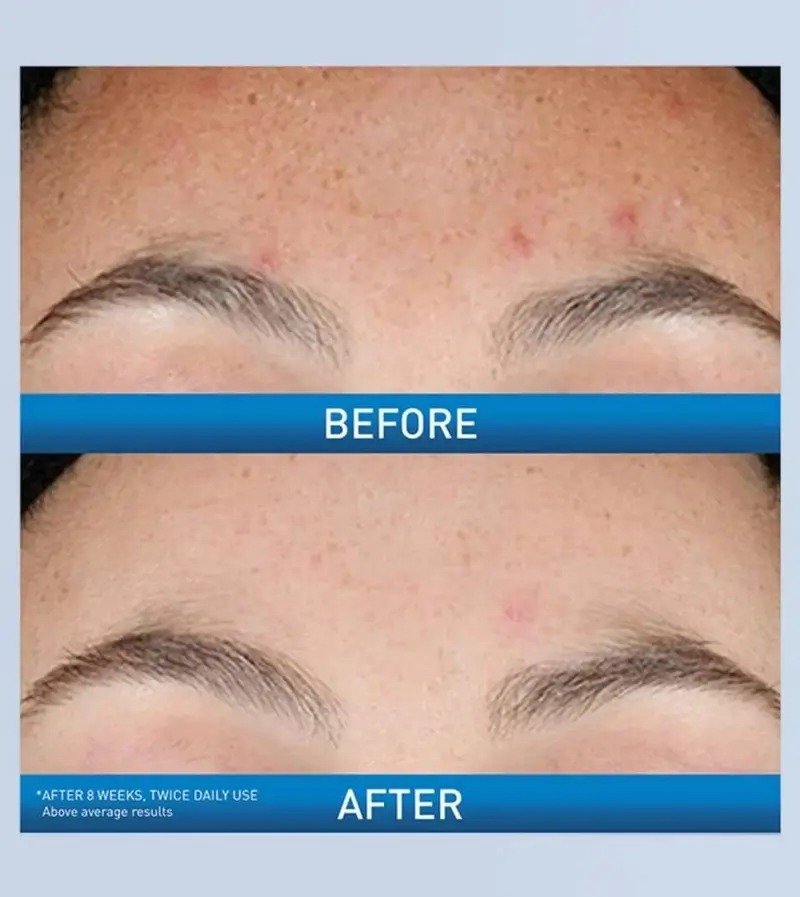 CeraVe Resurfacing Retinol Serum – (30ml) - Image 3