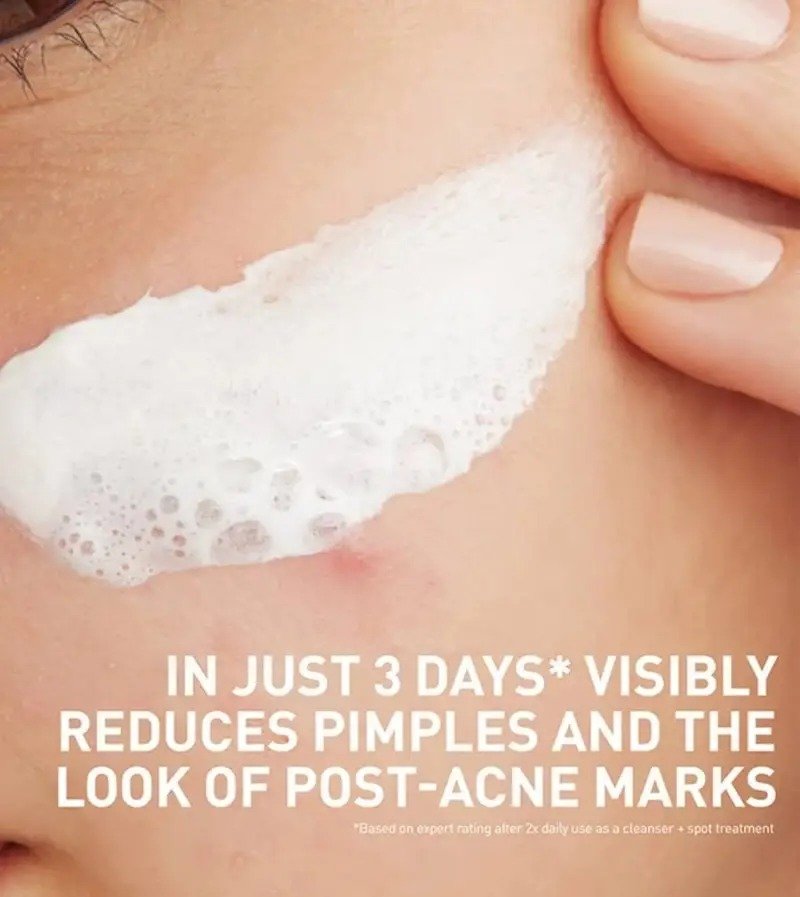 CeraVe Acne Clay To Foam Cleanser – (118ml) - Image 2