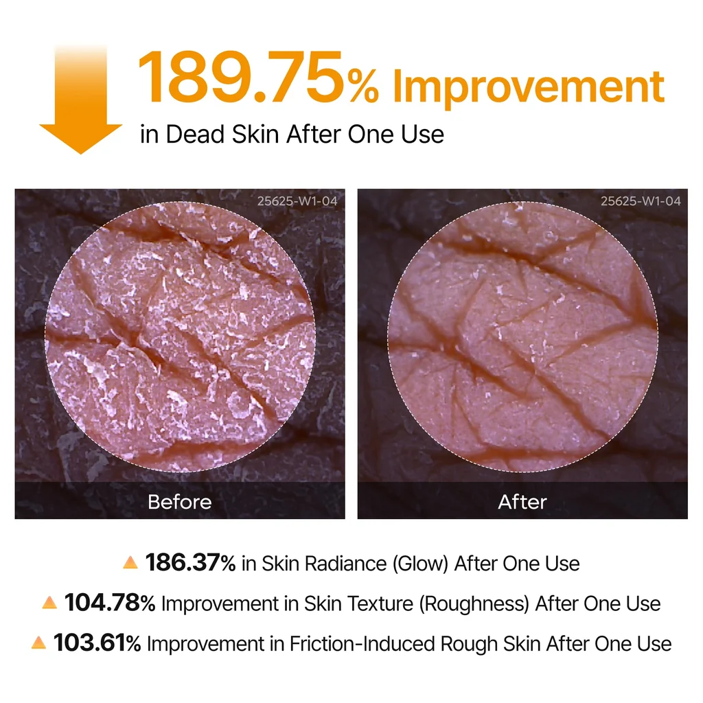 Dr.Melaxin Peel Shot Kojic Acid Turmeric Body Spray – (200ml) - Image 5