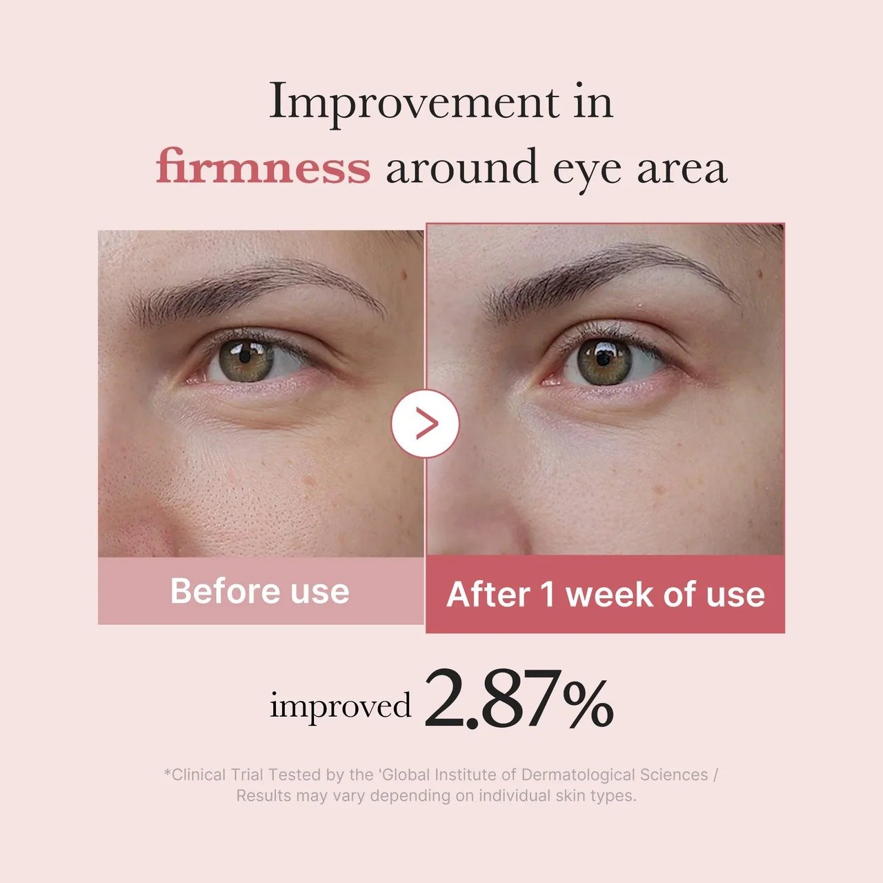 Medicube PDRN Pink Peptide Eye Cream - (30ml) - Image 5